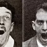Encephalitis Lethargica